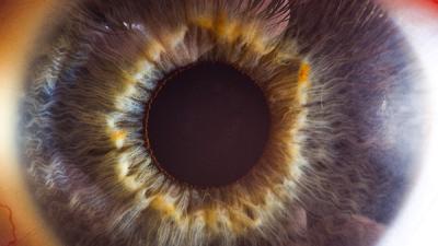 The Human Eye Looks Like A Crater