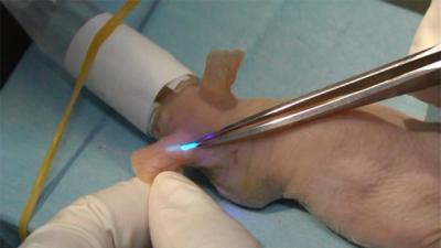 Glucose-Measuring Implant Glows When Sugar Levels Increase