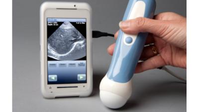 The MobiUS Is An Ultrasound Machine That’ll Fit In Your Pocket