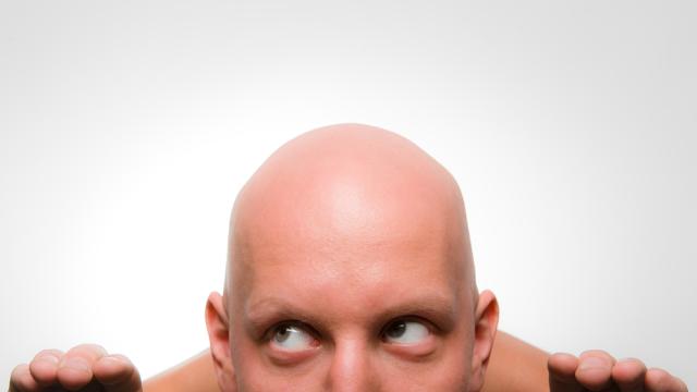 Scientists Work Out How To Stop You Going Bald