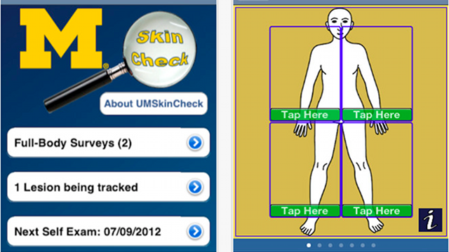 Are You Ready To Trust An iPhone App For Skin Cancer Diagnosis?