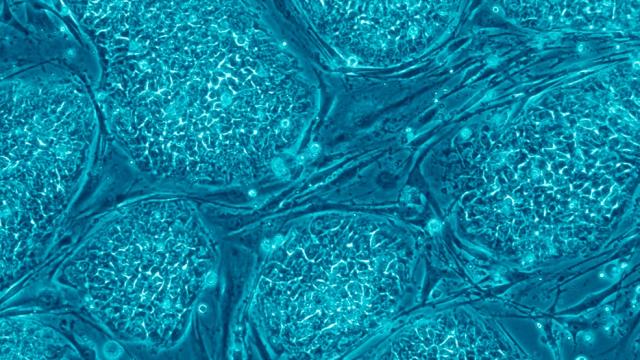 A Human Stem Cell Has Been Cloned For The First Time