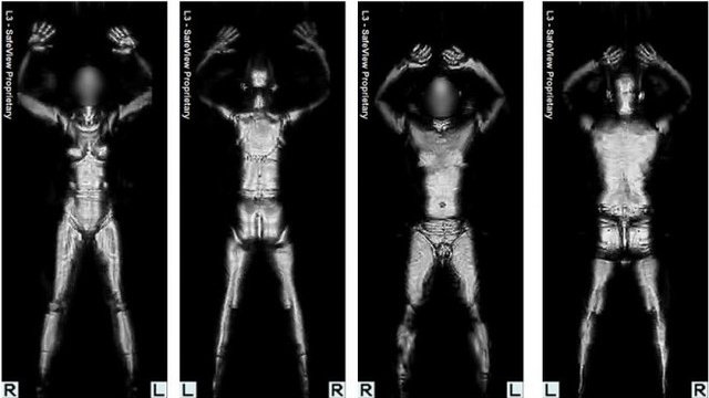 The TSA Has Finally Removed All Of Its Naked Full-Body Scanners