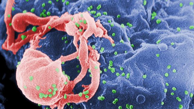 How A Supercomputer May Have Finally Unlocked A Way To Beat HIV