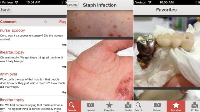 This Instagram For Doctors Lets You See Medicine’s Most Bizarre Cases