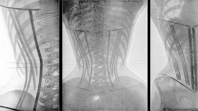 Taking X-Rays Of Women In Corsets Was A Haunting Use Of New Technology