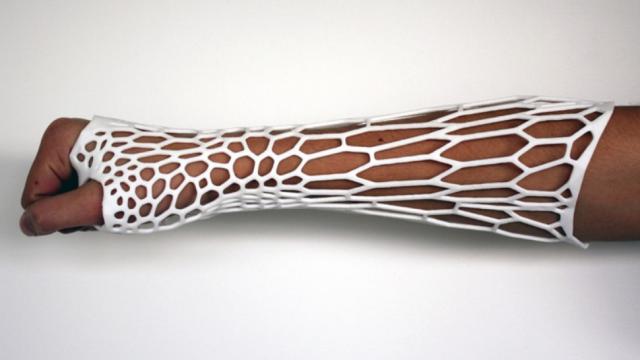 It’s Almost Worth Breaking Your Arm For This Crazy 3D-Printed Cast