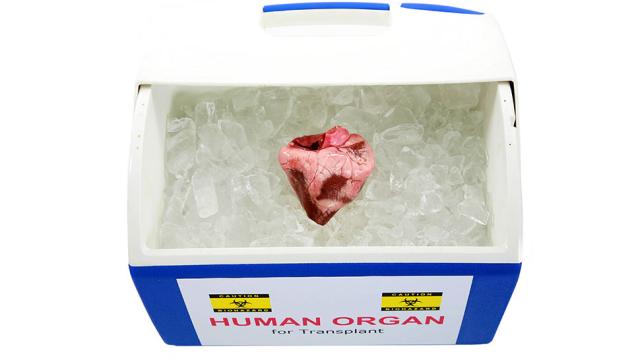 The Way Stats Decide Who Gets Organ Transplants In The US Is Flawed