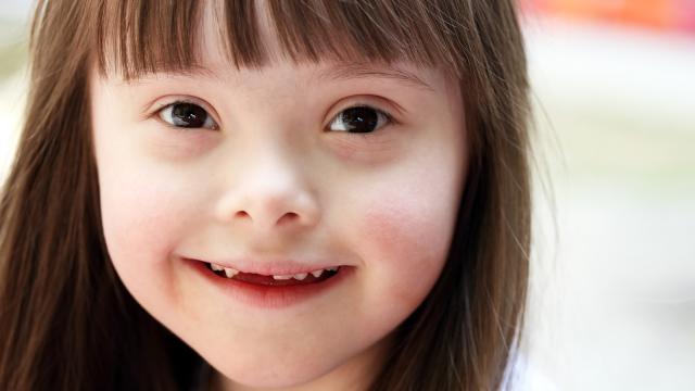 Scientists May Have Found A Genomic Off Switch For Down’s Syndrome