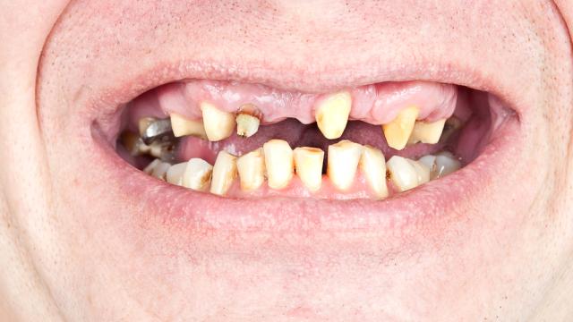 Scientists Grow Teeth From Scratch In The Worst Imaginable Way