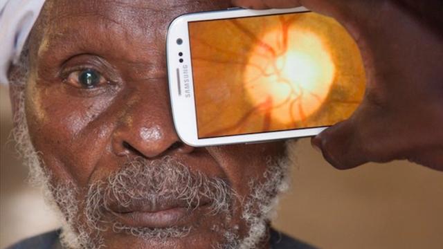 Your Smartphone Can Now Be Your Eye Doctor