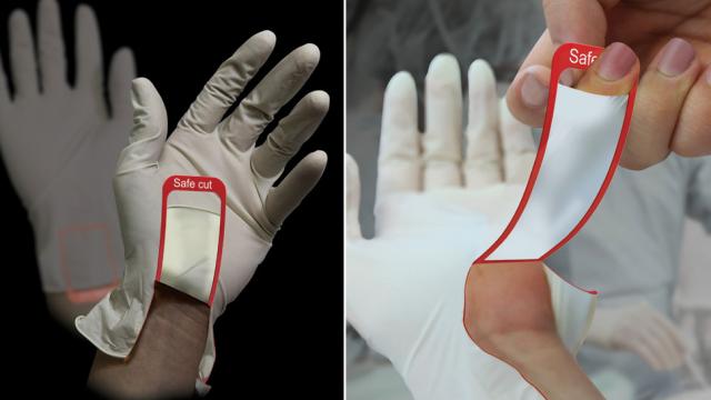 Are These Tear-Away Surgical Gloves Actually Safer?