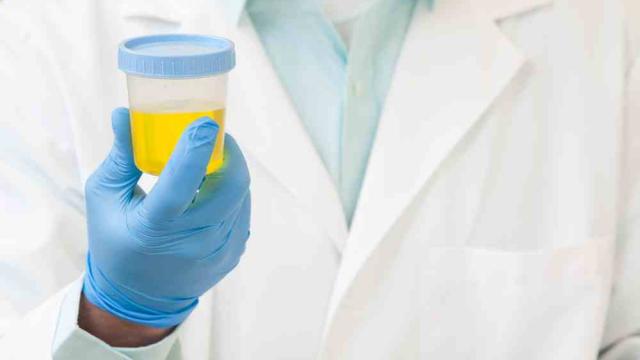 Why Do Vitamins Make Urine Bright Yellow?