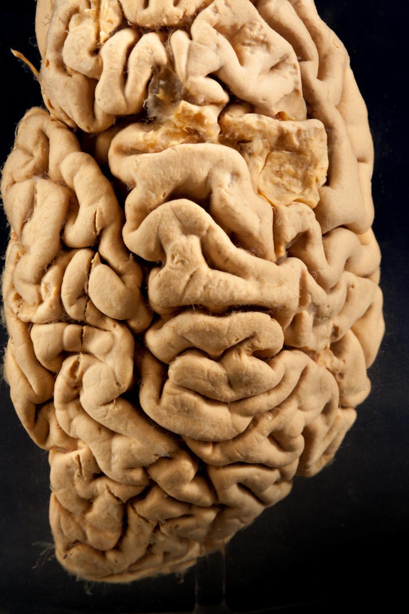 7 Mind-Blowing Artifacts That Reveal The Strange Beauty Of Brains