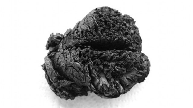 This 4000-Year-Old Brain Was Burned, Boiled, Shaken, And Is Still Intact