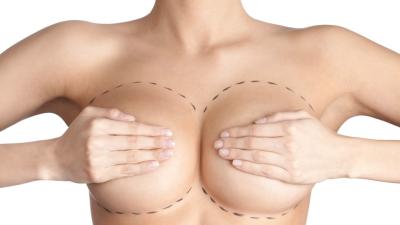 Breasts Age Faster Than The Rest Of A Woman’s Body
