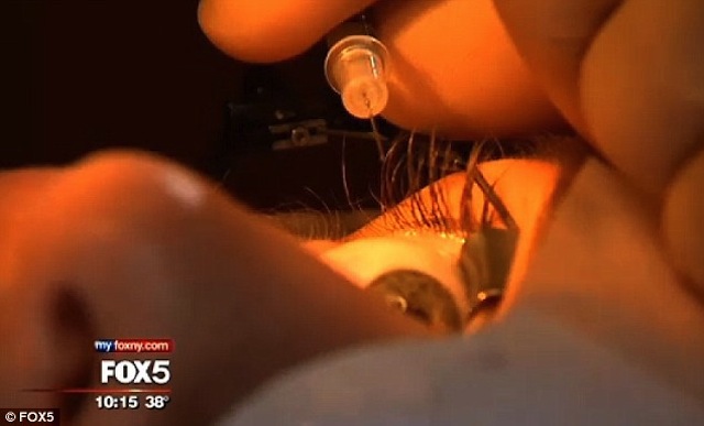 Woman Has Heart-Shaped Twinkle Surgically Implanted On Her Eyeball