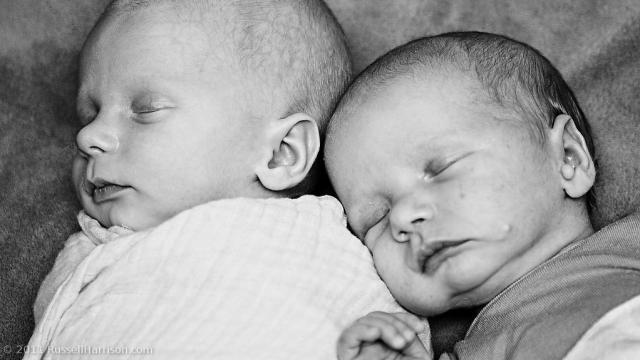 How Twins Were Born 87 Days Apart