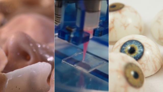 How 3D Printers Are Cranking Out Eyes, Bones And Blood Vessels