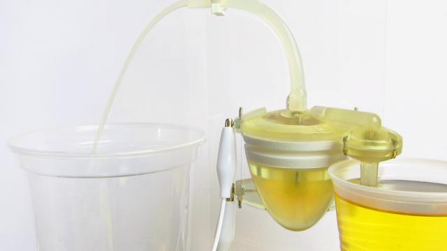 This 3D-Printed Robot Heart Runs On Nothing But Pee
