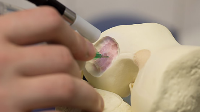Australian Handheld 3D Printer Could Let Doctors ‘Draw’ New Bones