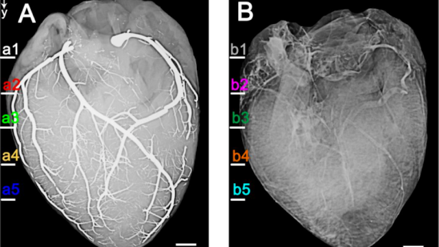 These Are The First Ever Images Of A Heart Injected With Liquid Metal