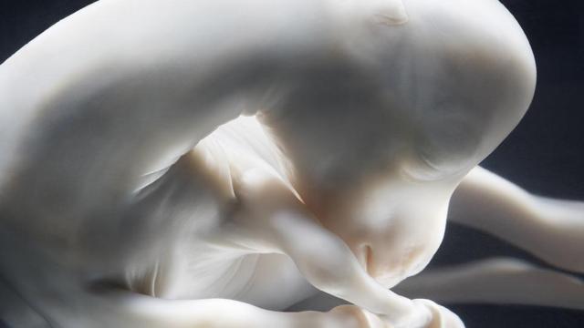 Incredible Photo Shows The Peaceful Alien Beauty Of A Horse Foetus