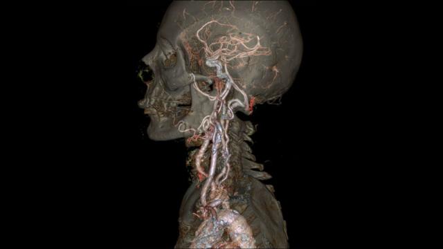 GE’s New Fast CT Scanner Captures Insane Images In A Heart Beat