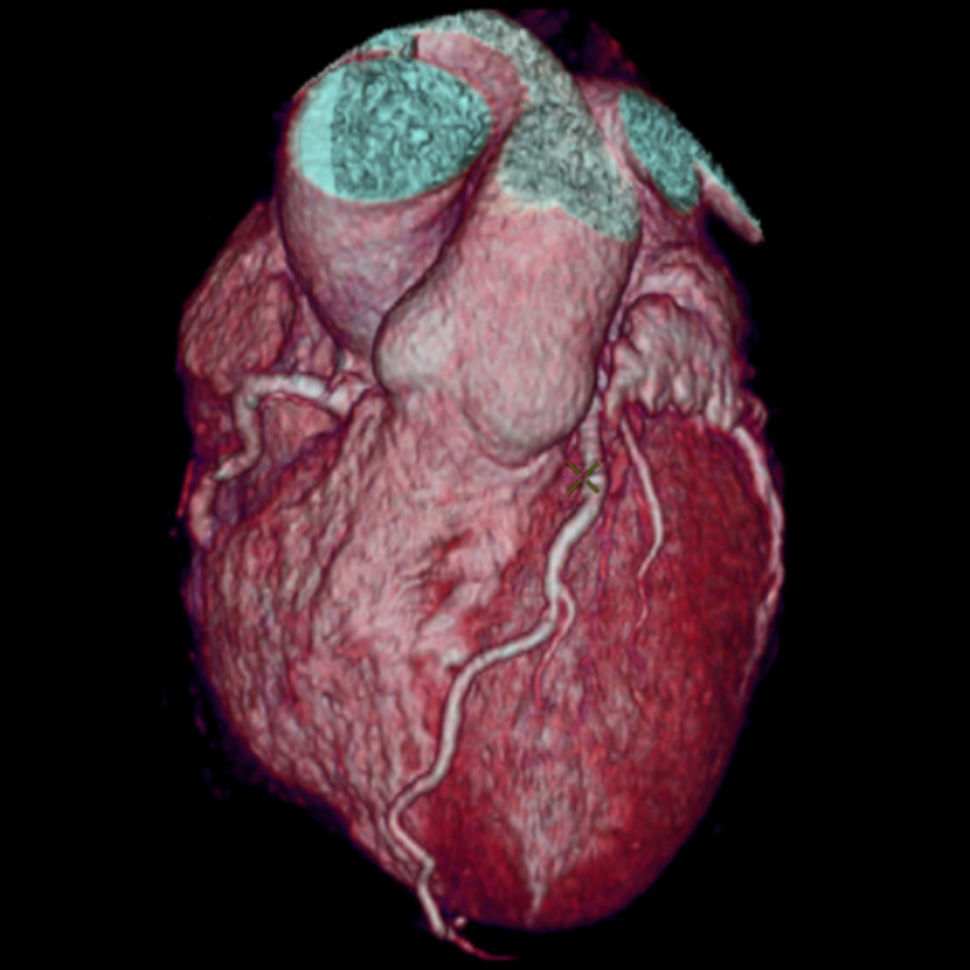 GE’s New Fast CT Scanner Captures Insane Images In A Heart Beat
