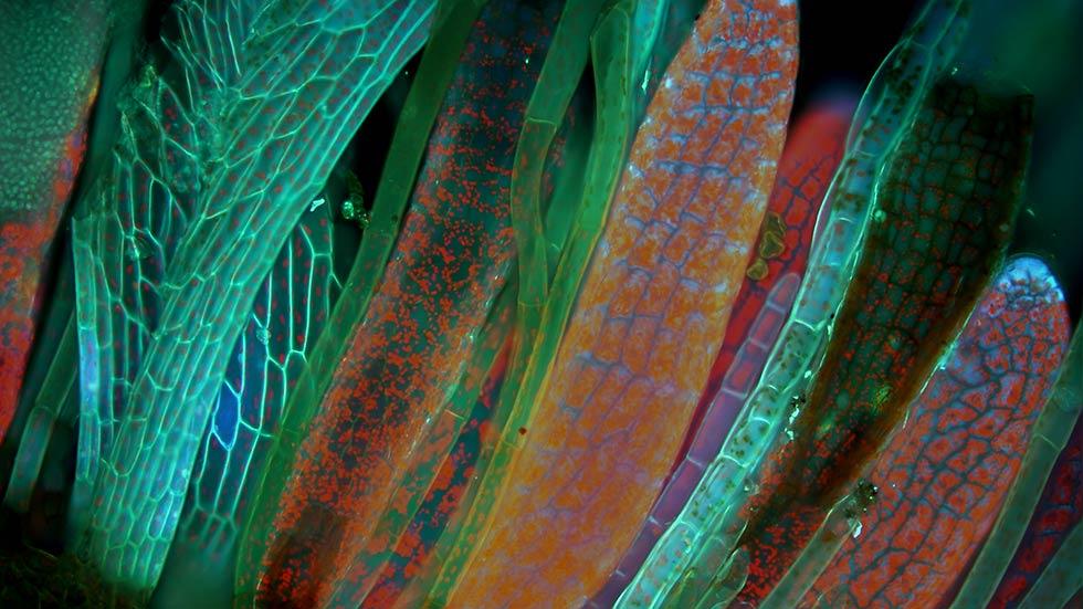 Behold The Monstrous Beauty Of This Year’s Coolest Microscopic Images