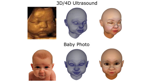 You Can Now Buy A Life-Size, 3D-Printed Replica Of Your Unborn Foetus