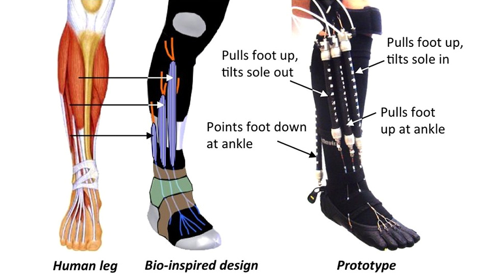 These Robotic Super Socks Will Aid Rehabilitation