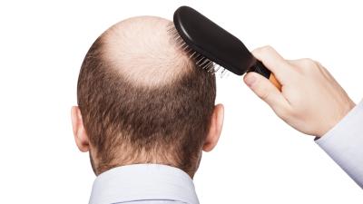 Researchers Grow New Hair From Stem Cells For The First Time
