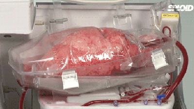 How A Human Lung Is Kept Alive And Breathing For A Transplant