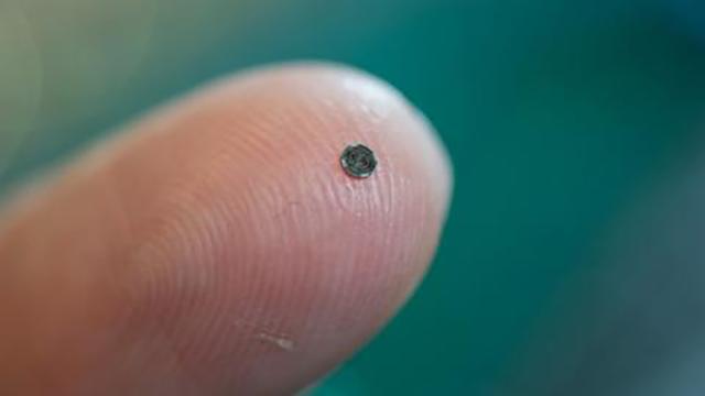 This Tiny Chip Could Give Doctors A 3D View From Inside The Heart