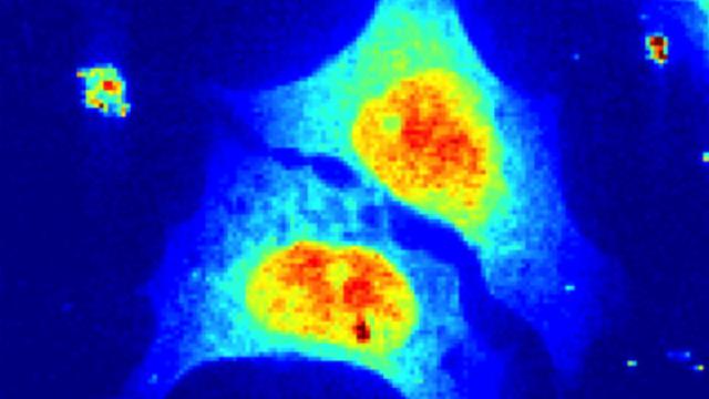 These Are The First X-Rays Of A Living Cell