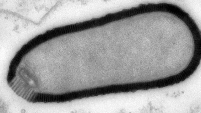 What A 30,000-Year-Old Giant Zombie Virus Means For The Future