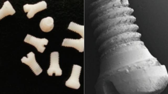 Someday, Surgeons Might Fix Your Broken Bones With Screws Made Of Silk