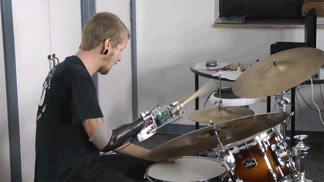 This Bionic Drummer Arm Is Like Def Leppard 2.0