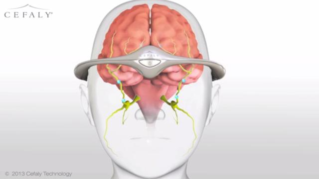 US Authorities Approve Migraine-Blasting Electric Headband