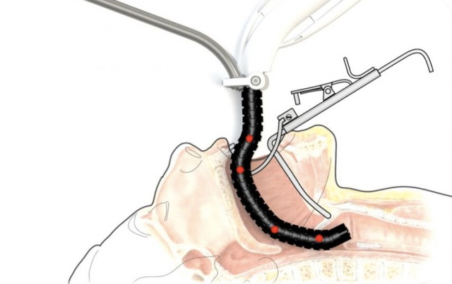 Oh Great, Surgeons Want To Shove These Robot Snakes Down Our Throats