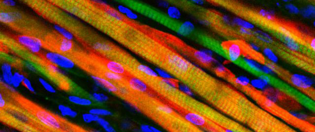 First Ever Lab-Grown Muscle That Can Heal Itself In Living Creatures