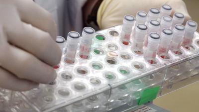 France Lost Thousands Of Vials Containing The SARS Virus