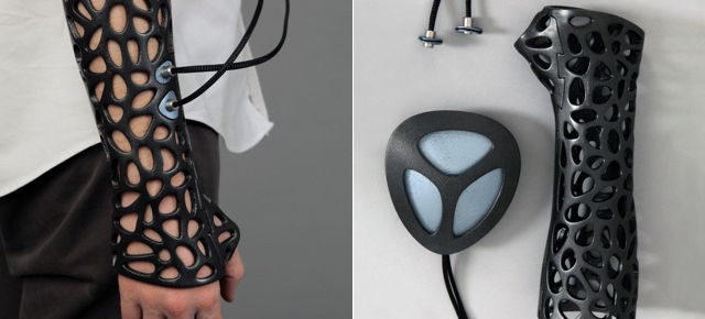 A 3D-Printed Ultrasound Cast That Looks Awesome And Heals You Faster