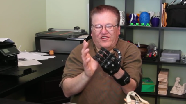 Man Explains Why He Prefers $50 3D-Printed Hand To $42,000 Prosthesis