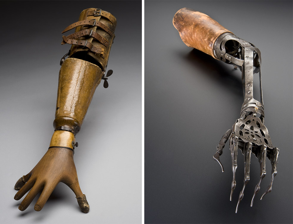 The Fascinating Untold History Of War And Prosthetics