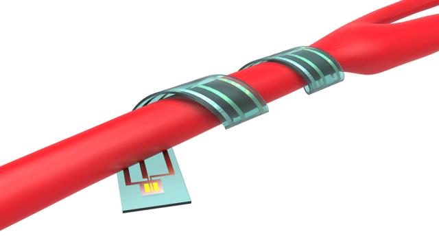 Researchers Make A Circuit So Flexible, It Can Wrap Around A Vein