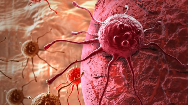 Giz Explains: Finding, Treating And Beating The Most Survivable Forms Of Cancer