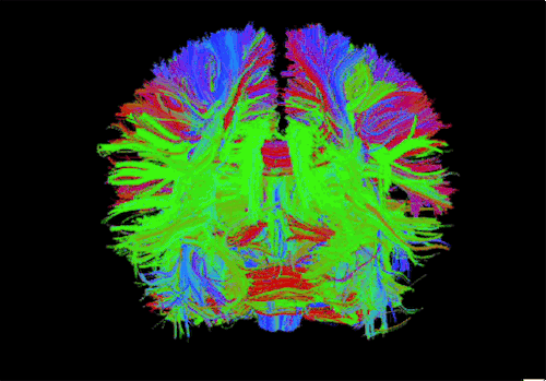 This Isn’t A Fright Wig. It’s How GE’s MRI Scanner Sees Your Brain