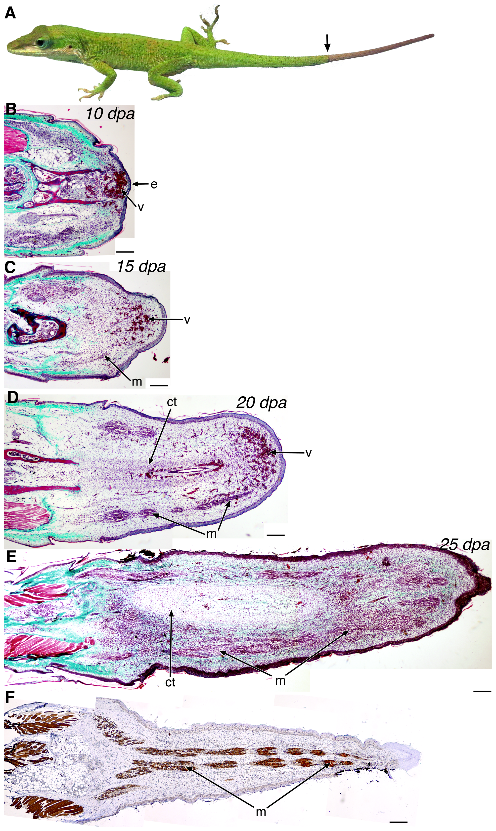 How Lizard Tails Could Help Scientists Study Human Limb Regeneration